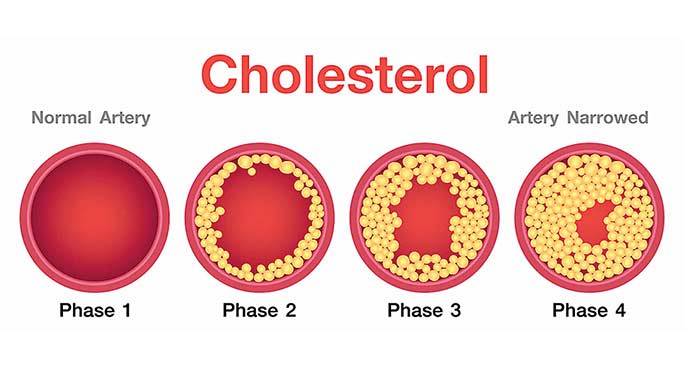 the-9-best-foods-to-lower-your-cholesterol-in-2020-cholesterol-foods