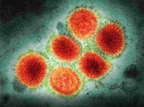 China detects another human case of influenza A H3N8
